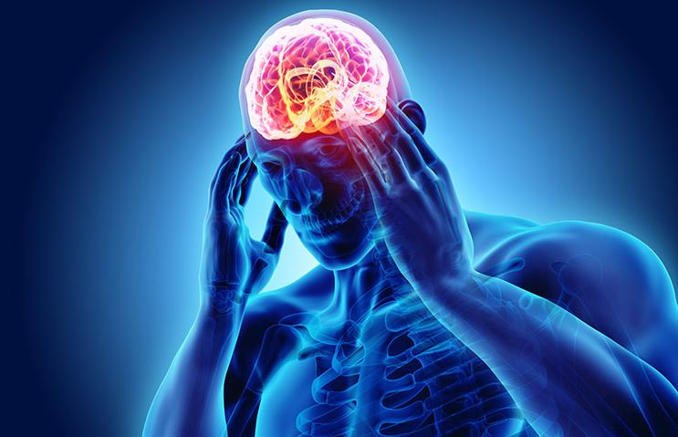 Is CBD Oil Effective for Migraine Pain
